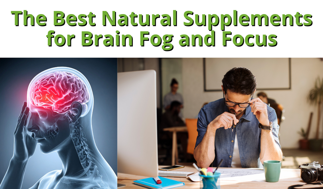 Brain Fog, Focus & Mental Clarity: Natural Supplements to Sharpen Your Mind