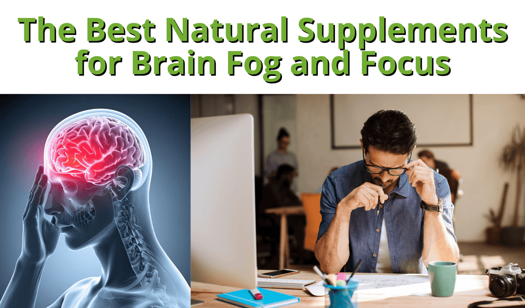 Brain Fog, Focus & Mental Clarity: Natural Supplements to Sharpen Your Mind